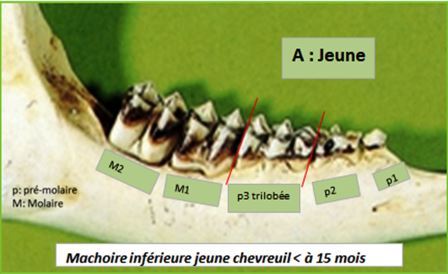 machoire jeune compresse